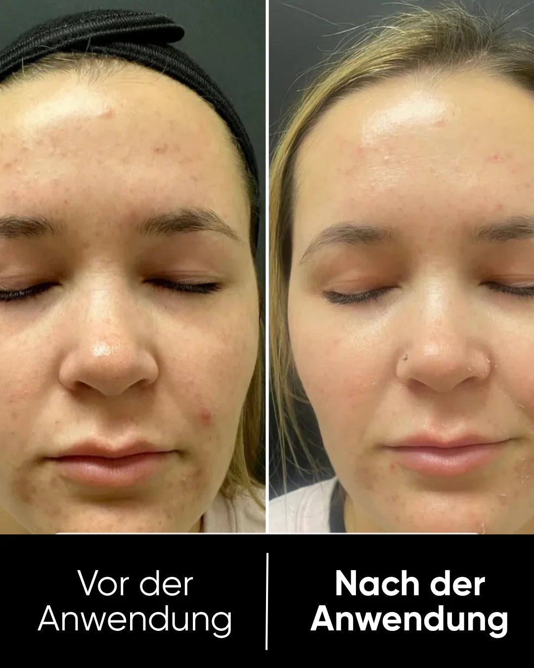 Peel Shot™ Exfoliant Rice Serum