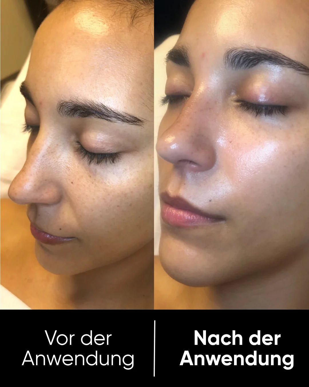 Peel Shot™ Exfoliant Rice Serum