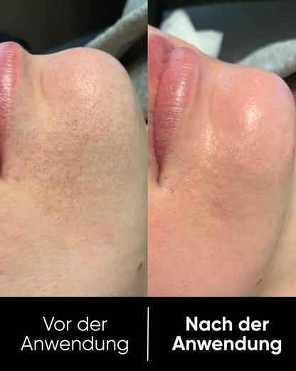 Peel Shot™ Exfoliant Rice Serum